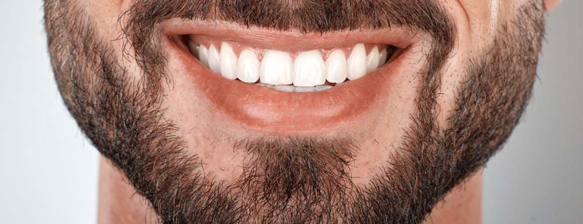 Exclusive teeth restoration